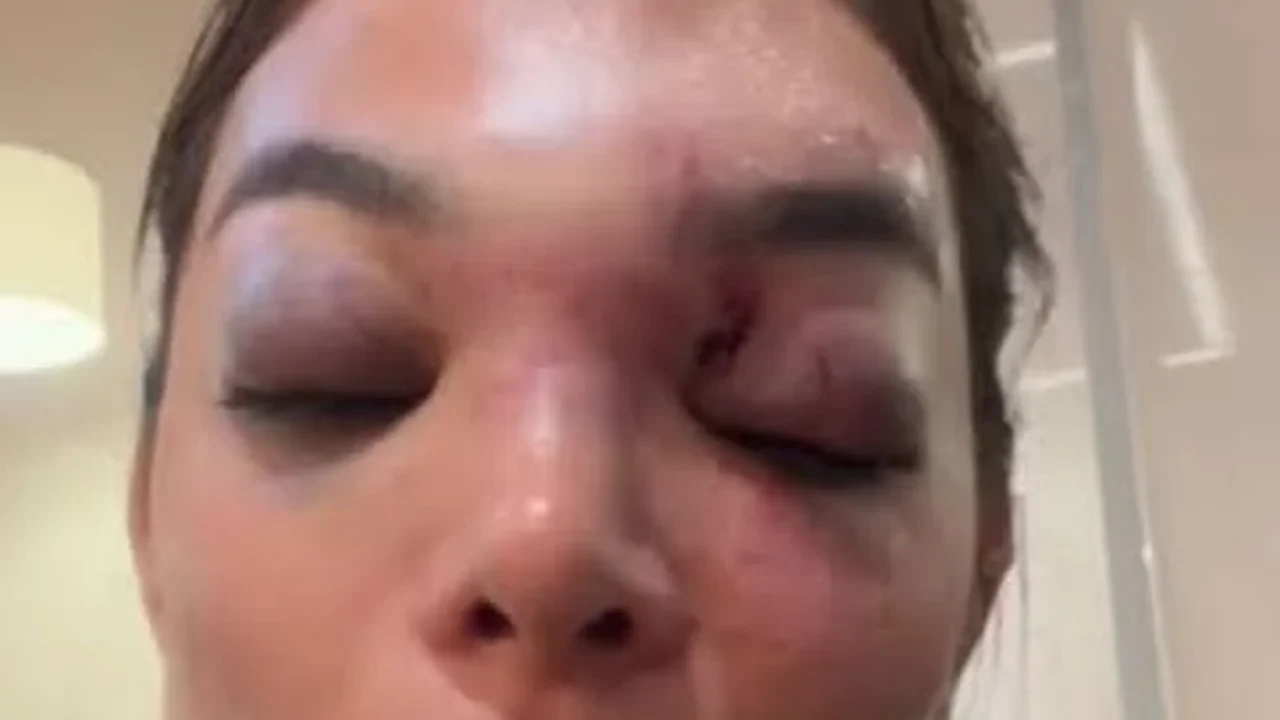 Dentista relata agressões de empresário da Faria Lima