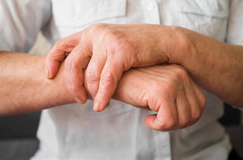 Campanha sobre hanseníase reforça o papel do HUPAA no diagnóstico, tratamento e combate ao estigma