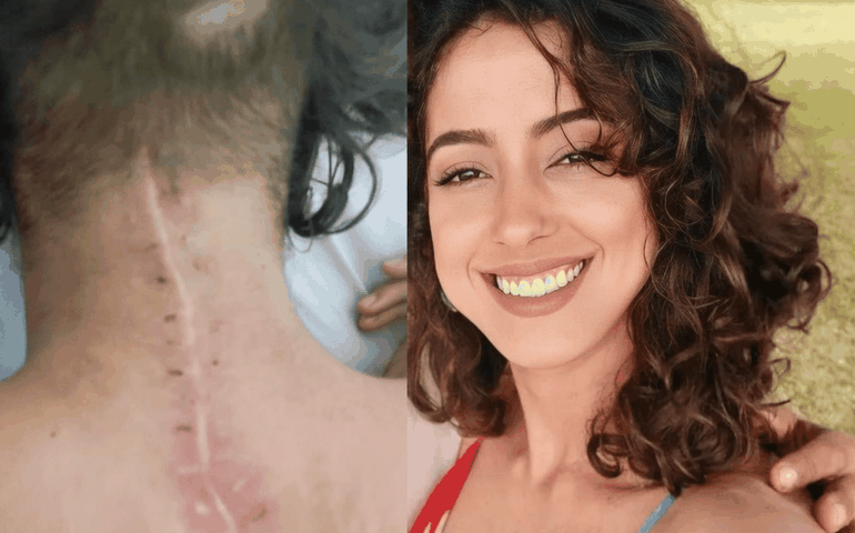 Mulher perde movimentos após sofrer queda durante prática de acroyoga