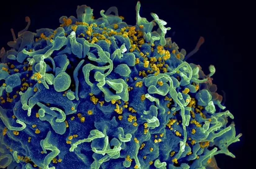 Estudo revela que vacina de mRNA gera forte resposta imune contra HIV em 80% dos participantes