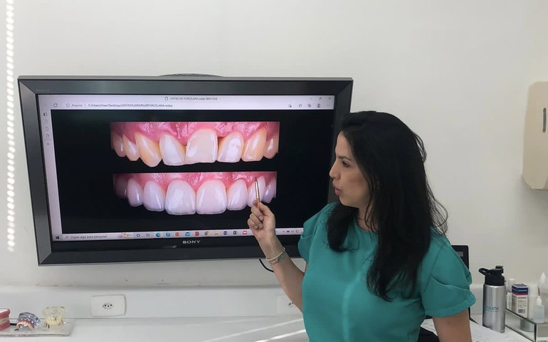 Cirurgiã dentista comenta procedimentos que substituem a tradicional dentadura