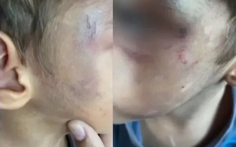 Casal acusado de torturar filho de quatro anos se torna réu em Maceió