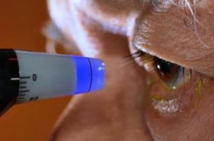 Clínicas devem manter tratamento de glaucoma em Maceió, cobra SMS