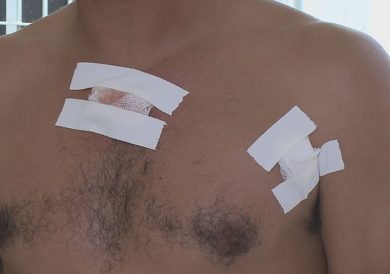 Agente de trânsito atira no peito de homem após discussão fútil