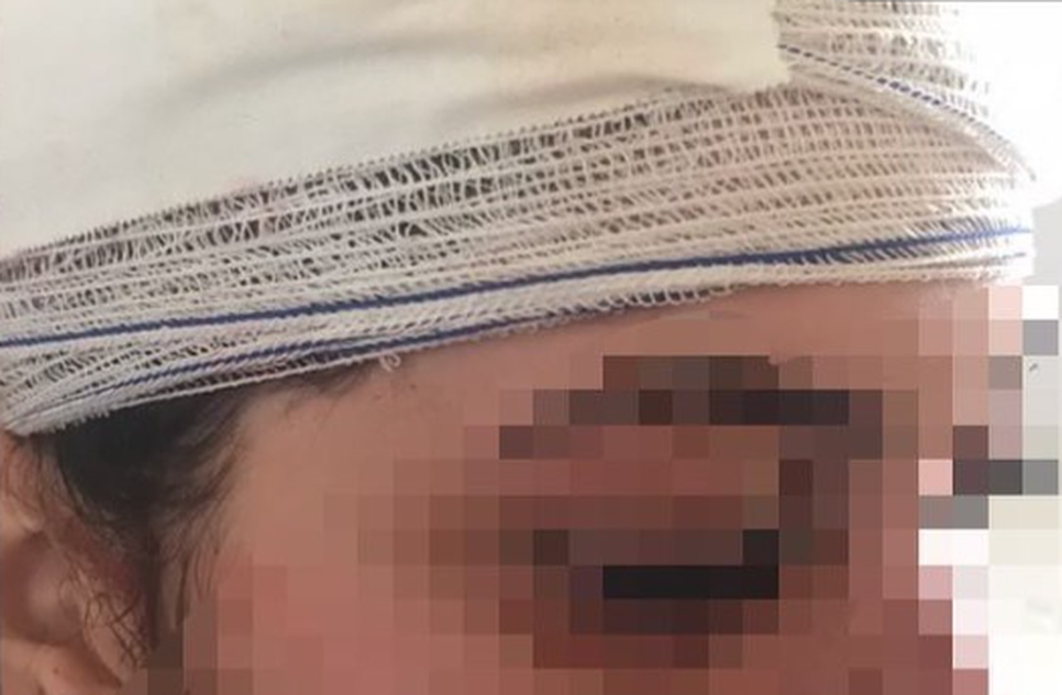 Mulher é empurrada e agredida durante festa em Itabaiana