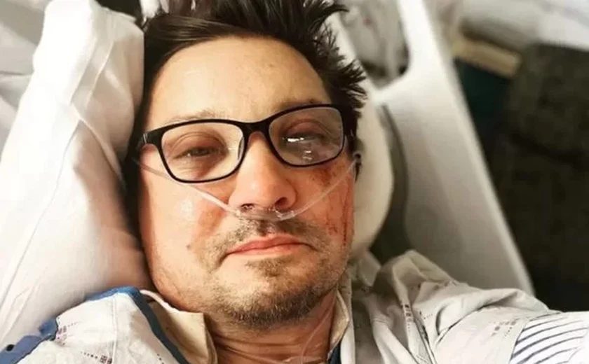 Jeremy Renner faz primeira aparição após acidente: “Esculhambado”