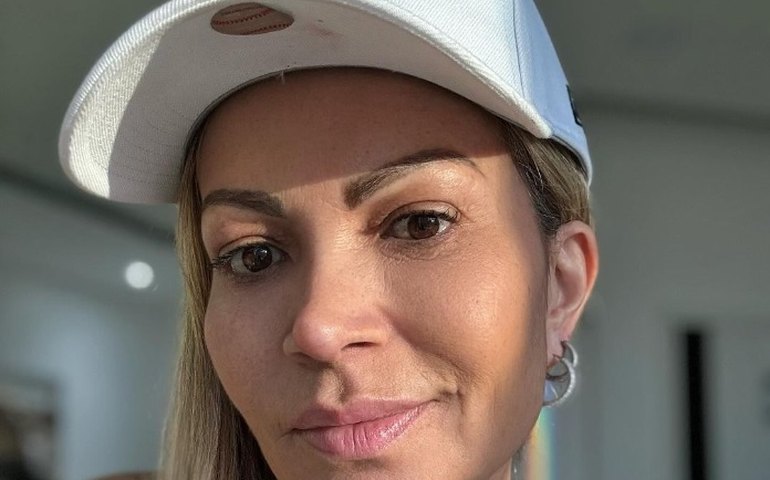 Solange Almeida passa por cirurgia não programada e adia compromissos