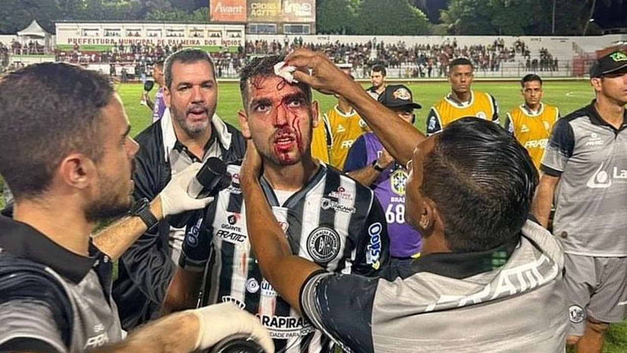 ASA registra BO na polícia contra agressão sofrida pelo volante Allef, no jogo contra o CSE