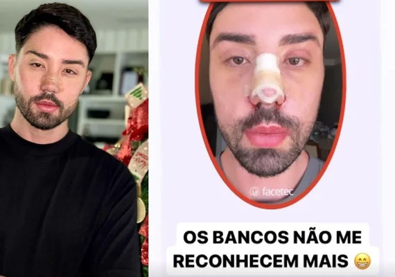 Rico Melquíades diz que inteligência artificial não o reconhece após mudança estética no rosto