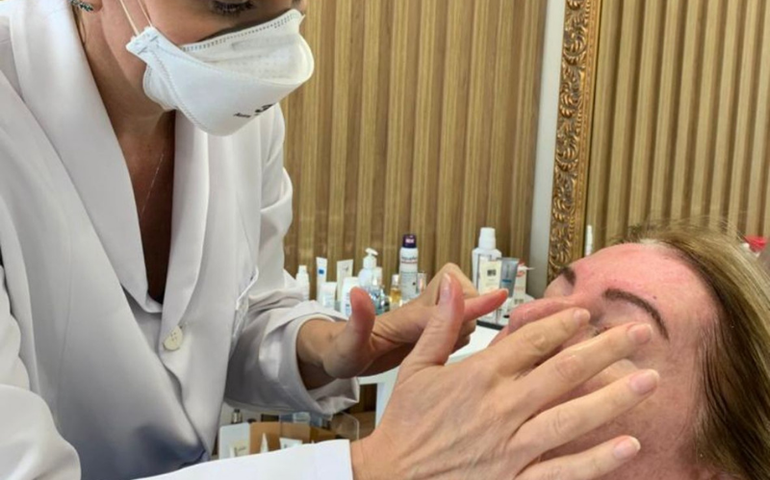 Gravidez é fator de risco para o melasma, diz pesquisa