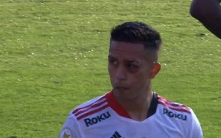 Igor Vinícius é diagnosticado com pubalgia e não treina no São Paulo