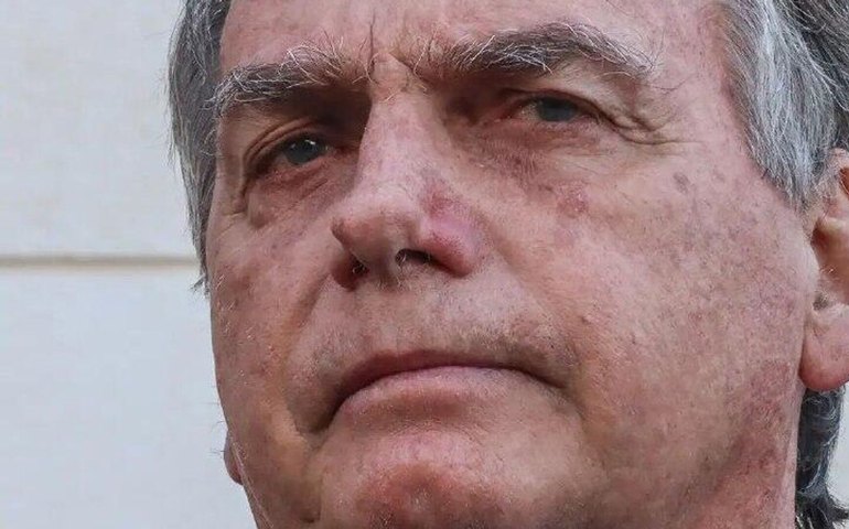 Bolsonaro passa por audiência de custódia neste domingo para avaliar legalidade da prisão