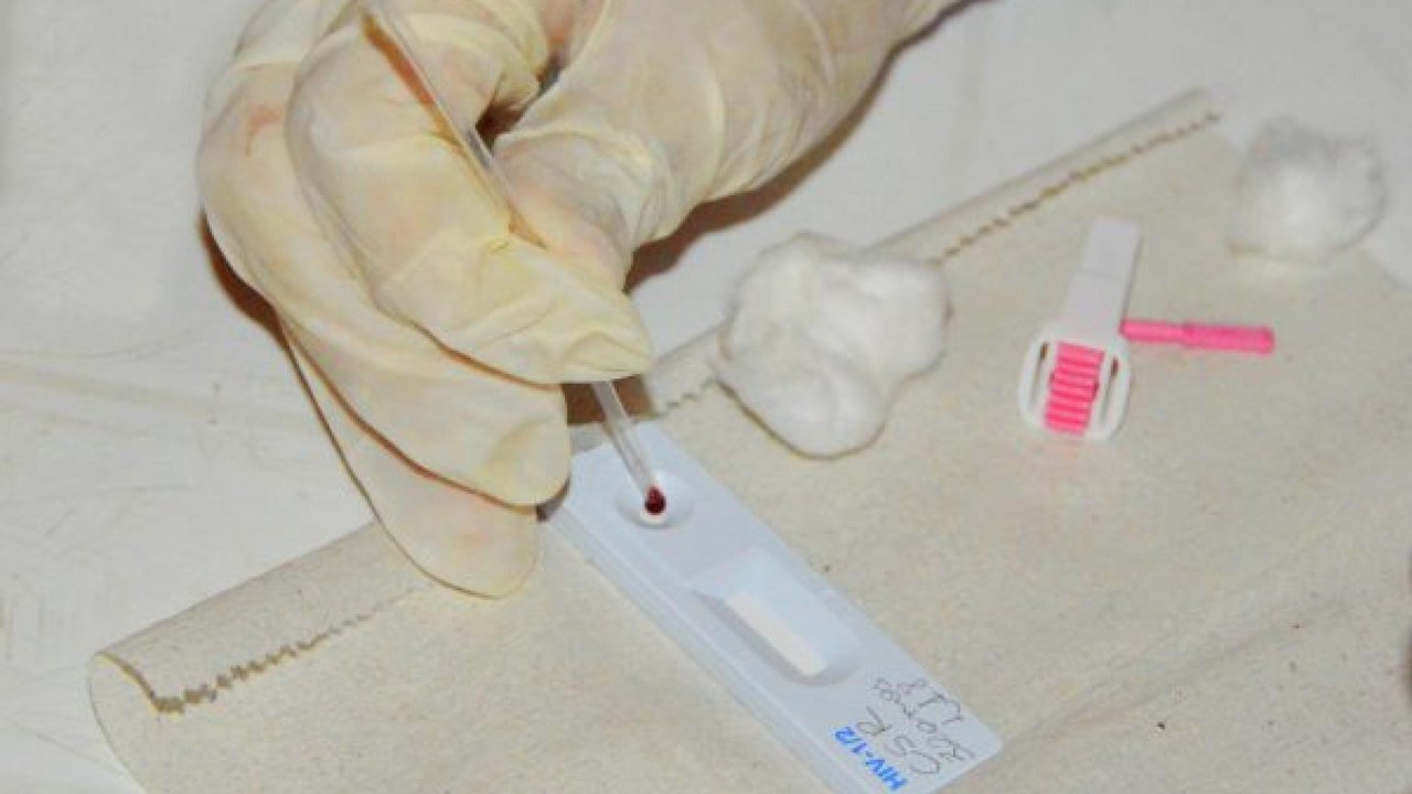 Sesau orienta população sobre cuidados para prevenção de ISTs