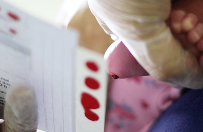 Na primeira etapa da ampliação do Teste do Pezinho, Governo Federal incorpora exame para toxoplasmose