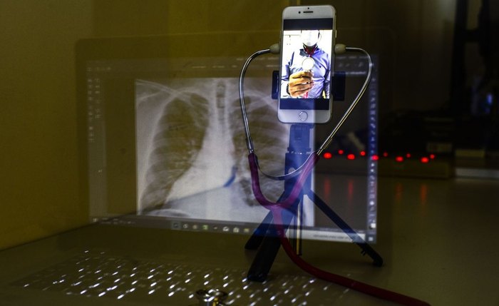 Doença pode causar tuberculose geniturinária