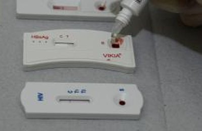 Campanha incentiva médicos a pedirem exames para detectar hepatite C