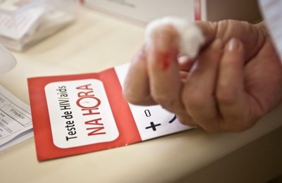 Vigilância Epidemiológica para Aids e HIV apresenta boletim 2016