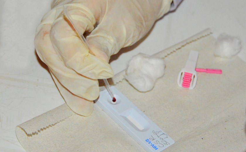 Se expôs ao vírus HIV durante o Carnaval? Saiba quando e onde realizar o Teste Rápido de Detecção