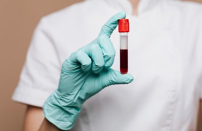 Startup usa IA para interpretar 20 mil hemogramas em busca de doenças graves no sertão pernambucano