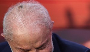 Cirugia na cabeça de Lula. Fonte: Internet