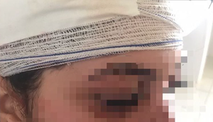 Mulher é empurrada e agredida durante festa em Itabaiana