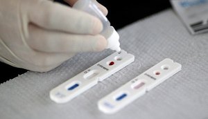 teste coronavirus