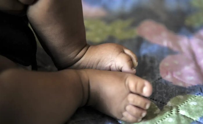 Conjunto de políticas adotadas pelo Brasil tem diminuído as mortes preveníveis de crianças