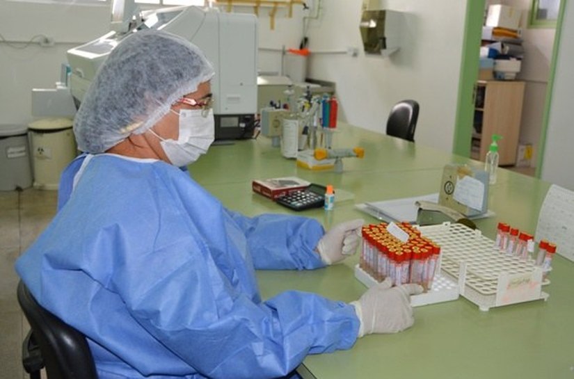 Lacen vai capacitar profissionais para o diagnóstico do Zika vírus