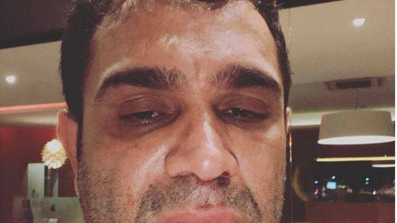Evandro Santo, ex-‘Pânico’, assume vício em drogas: ‘Saindo do armário’
