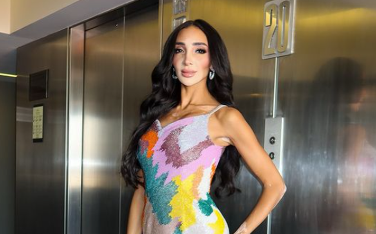Miss Universo tem pela 1ª vez candidata com vitiligo; entenda o que é a doença