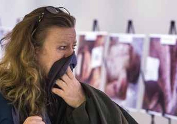 É imperativo não desviar o olhar: ONU expõe fotos chocantes de vítimas do conflito da Síria