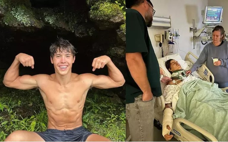 TikToker de 18 anos é hospitalizado após cair de penhasco em rochas de lava quente no Havaí