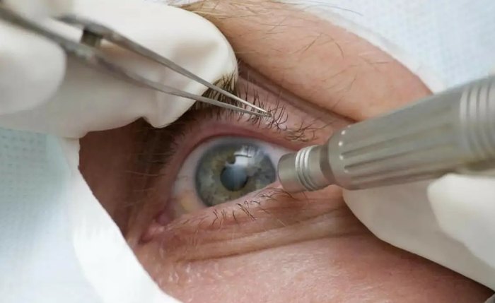 Cirurgia é avaliada em R$ 30 mil, em Alagoas