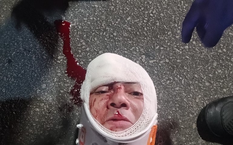 Músico alagoano é atropelado na faixa exclusiva para ciclistas