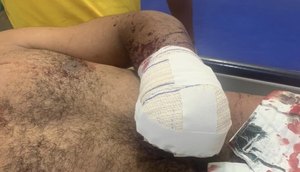 Homem tem mão decepada com facão durante discussão em Itabaianinha / Foto: Foto: Polícia Militar/Divulgação