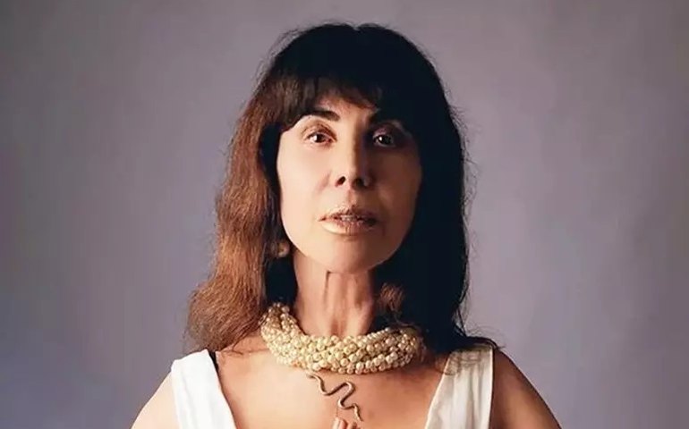 Internada há uma semana, Claudia Alencar passará por cirurgia na coluna