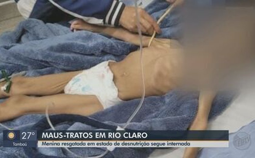 Após resgate, menina desnutrida já ganhou 2 quilos: 'A gente não sabe como ela resistiu a isso', diz médica
