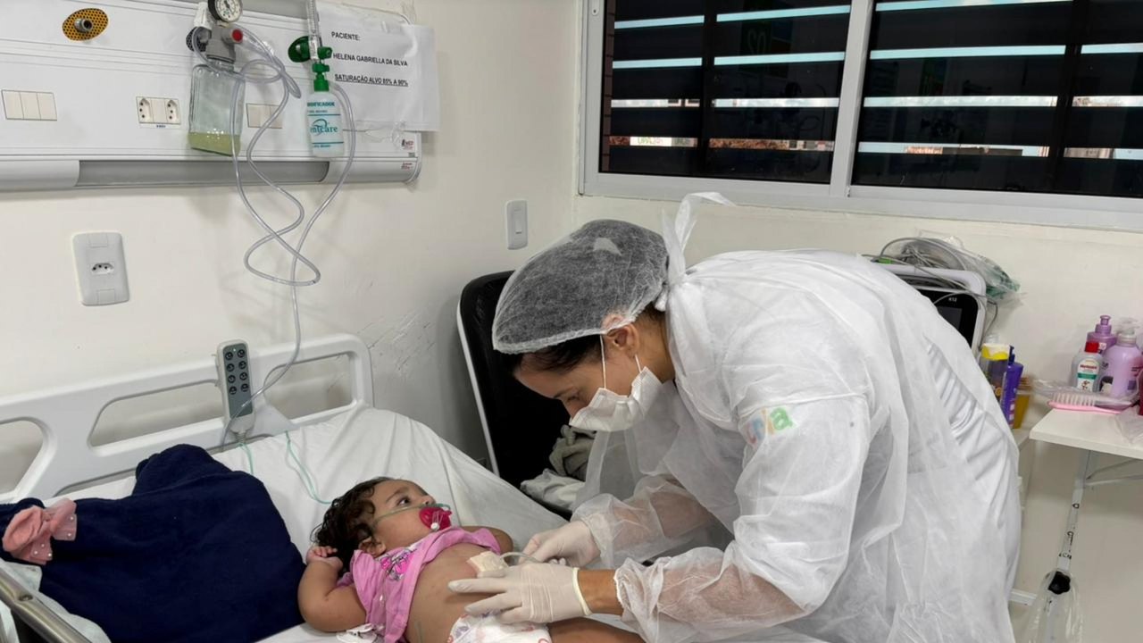 Enfermeiras do Hospital da Criança orientam sobre cuidados em casos de queimaduras nas festas juninas