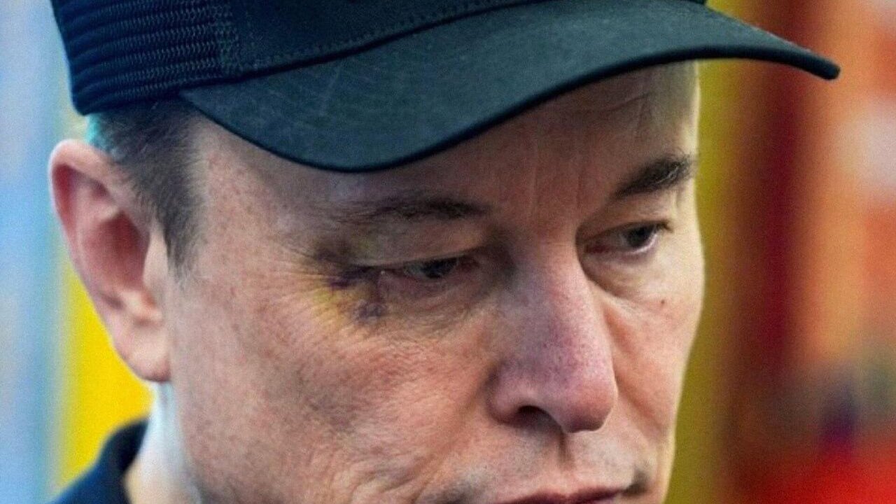 Musk aparece com hematoma no olho em cerimônia com Trump na Casa Branca