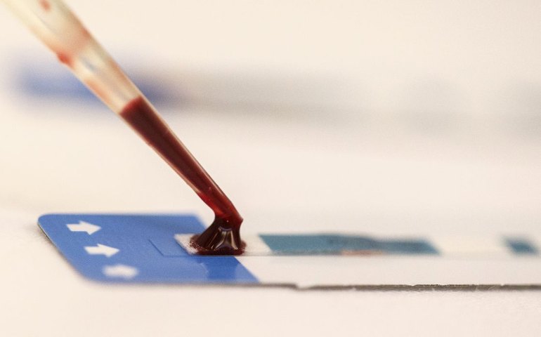 Estudo inédito da Fiocruz pode ampliar prevenção de HIV entre jovens