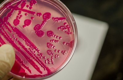 Resistência a antibióticos causa 1,27 milhão de mortes no mundo e 34 mil no Brasil por ano