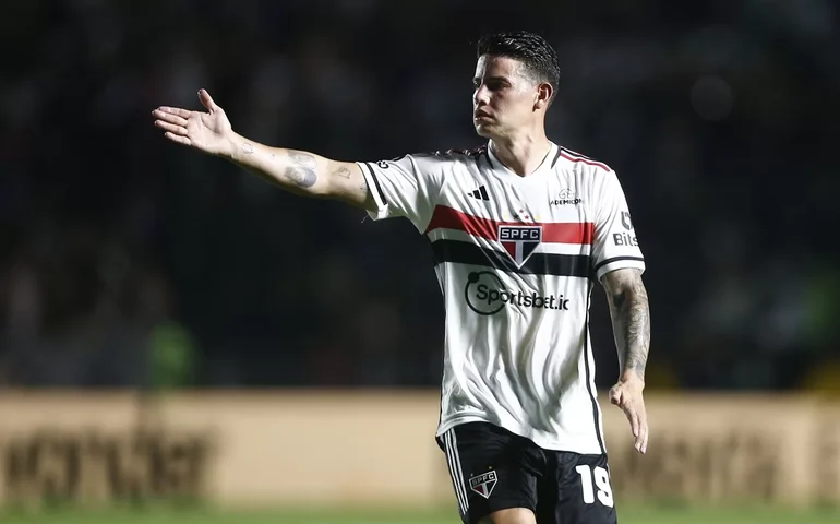 Carpini mantém calma com relação a James Rodriguez: 'Ele está num estágio físico diferente'
