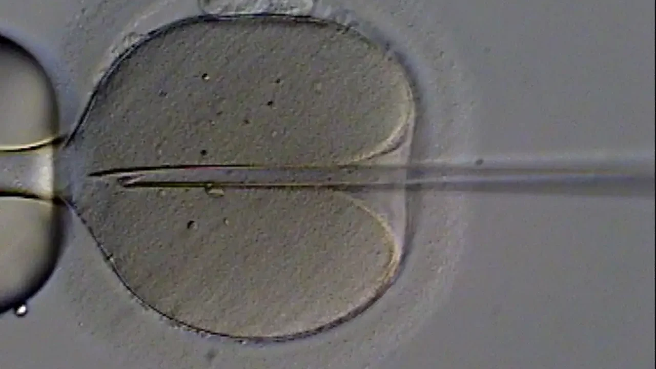 Fertilização in vitro: 40 anos após 1º bebê de proveta no Brasil, área tem avanços sociais e tecnológicos