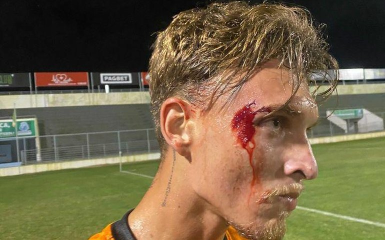 Diretoria do ASA lamenta episódios que aconteceram no final do jogo diante do CSE