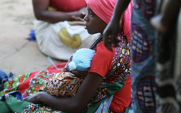 Africanas sofrem problemas de saúde e golpes ao se submeterem a tratamentos para clarear a pele