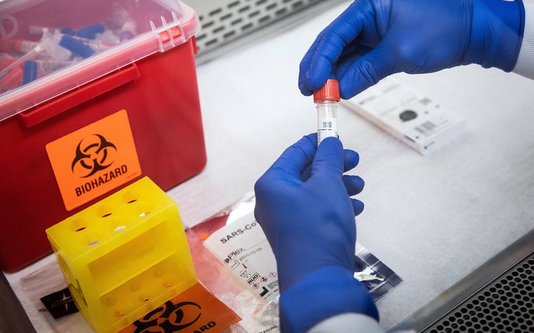 Araxá (MG) adquire sete mil exames e vai testar 6,5% da população do município