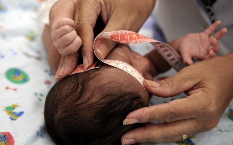 Audiência na Câmara discute cuidados com crianças que nasceram com microcefalia por causa do Zika vírus