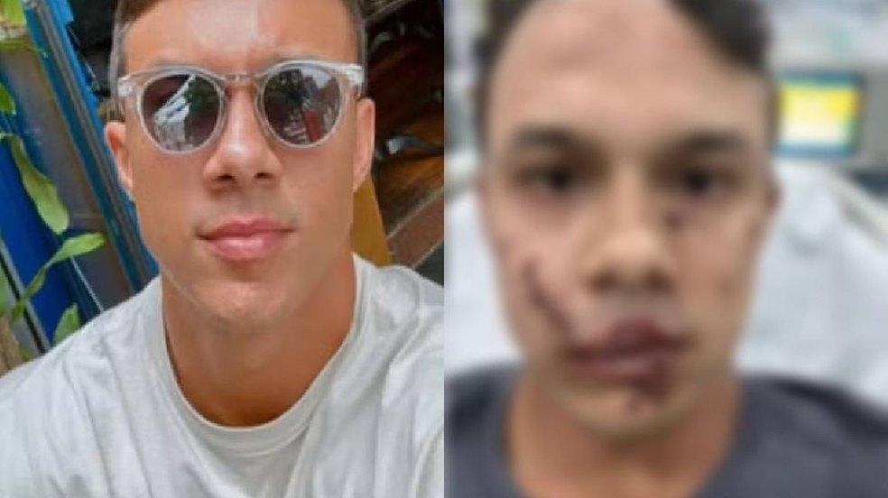 Personal trainer é brutalmente agredido com copo de vidro ao tentar defender mulheres em bar de Águas de Lindóia (SP)