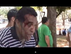 Evangelista é agredido com pedrada enquanto pregava em praça pública