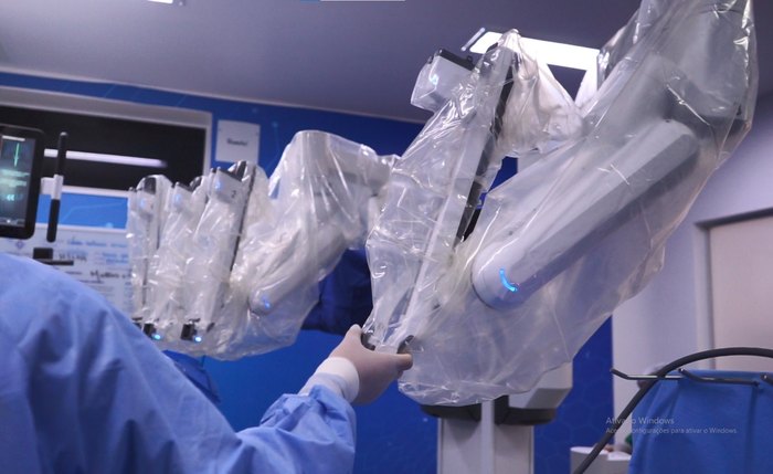 Santa Casa de Maceió completou três anos da implantação da cirurgia robótica celebrando números expressivos